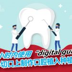 在1小时内使用“digital guide”在小切口上制作口腔植入种植牙
