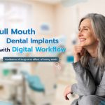 Full Mouth Dental Implants (All on 4) with Digital Implants Workflow – Avoidance of Long-term Effect of Losing Teeth