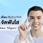 3 เดือน ฟันห่างก็ชิดได้ด้วย จัดฟันใส Käse Aligner