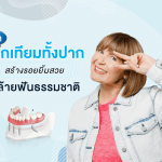 ทำรากเทียมทั้งปาก สร้างรอยยิ้มสวยคล้ายฟันธรรมชาติ