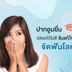 ปากอูมยื่น ปล่อยไว้ไม่ดี รีบแก้ไขด้วยจัดฟันโลหะ