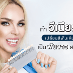ทำวีเนียร์ เปลี่ยนฟันสีเข้มเป็นฟันขาวสวย