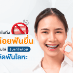 ทำไมถึงปล่อยฟันยื่นไว้ไม่ได้ รีบแก้ไขด้วย จัดฟันโลหะ