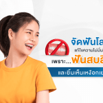 จัดฟันโลหะ แก้ไขความไม่มั่นใจ เพราะฟันสบลึกและยิ้มเห็นเหงือกเยอะ