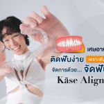เศษอาหารติดฟันง่ายเพราะฟันซ้อนเก จัดการด้วย จัดฟันใส Käse Aligner
