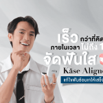 เร็วกว่าที่คิด ภายในเวลาไม่ถึง 1 ปี จัดฟันใส Käse Aligner แก้ไขฟันซ้อนเกให้เสร็จได้!