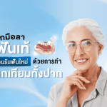 โบกมือลาฟันแท้ ต้อนรับฟันใหม่ด้วยการ ทำรากเทียมทั้งปาก