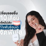 เปลี่ยนรอยยิ้มใน 10 เดือน : เคล็ด(ไม่)ลับแก้ไขฟันซ้อนเกด้วย จัดฟันใส