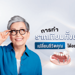 การ ทำรากเทียมทั้งปาก เปลี่ยนชีวิตคุณได้อย่างไร?