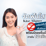 จัดฟันใส Käse Aligner เคลียร์ฟันยื่น ฟันซ้อนเก พร้อมมีรอยยิ้มมั่นใจใน 12 เดือน