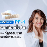 สะพานฟันไร้เหงือก FP-1 สำหรับรากเทียมทั้งปาก ทางเลือกที่ดูธรรมชาติกว่า แนบเหงือกจริงไม่มีโป๊ะ