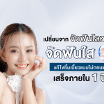 เปลี่ยนจากจัดฟันโลหะ มา จัดฟันใส แก้ไขยิ้มเบี้ยวแบบไม่ถอนฟัน เสร็จภายใน 1 ปี