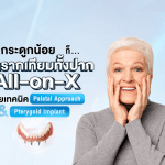 กระดูกน้อยก็ ทำรากเทียมทั้งปาก All-on-X ได้ ด้วยเทคนิค Palatal Approach & Pterygoid Implant