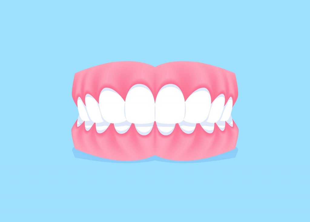 ฟันงุ้มเกิดจากอะไร