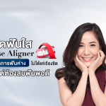จัดฟันใส Käse Aligner จัดการฟันห่าง ไม่ได้แค่เรียงชิด แต่ต้องสบฟันพอดี