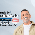 เคสจริง! รากเทียมทั้งปาก: จากฟันหายหลายซี่ สู่รอยยิ้มดูเป็นธรรมชาติและมั่นใจ