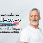 รากเทียมทั้งปาก All-on-4 สำหรับฟันบน สร้างฟันใหม่ ที่ให้ผลลัพธ์ใกล้เคียงธรรมชาติที่สุด
