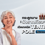 กระดูกบางก็ฝังรากฟันเทียมได้เลย เปิดเทคนิค Tenting Pole ที่ย่นเวลาการรักษา