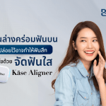 ฟันล่างคร่อมฟันบน ปล่อยไว้อาจทำให้ฟันสึก แก้ไขด้วยจัดฟันใส Käse Aligner