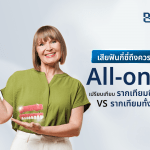 เสียฟันกี่ซี่ถึงควรทำ All-on-4? เปรียบเทียบรากเทียมซี่เดียว vs รากเทียมทั้งปาก