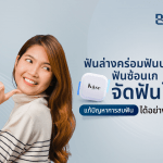 ฟันล่างคร่อมฟันบน ฟันซ้อนเก จัดฟันใสแก้ปัญหาการสบฟันได้อย่างไร?