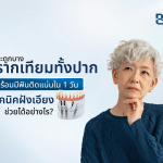 กระดูกบาง ทำรากเทียมทั้งปากพร้อมมีฟันติดแน่นใน 1 วัน เทคนิคฝังเอียงช่วยได้อย่างไร?